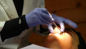 Ayo, Cek Kesehatan Gigi dan Mulut di Bulan Kesadaran Kanker Mulut