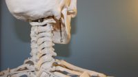 Mengenal Osteoarthritis dan Osteoporosis, Penyakit Tulang Pada Usia Lanjut