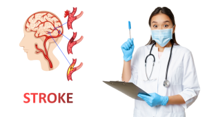 Simak, Perbedaan Stroke Ringan dan Stroke Ini Perlu Diketahui