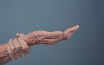 Meredakan Gejala Osteoporosis Pada Lansia