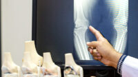 Penyakit Paget Menyebabkan Nyeri Tulang Pada Lansia
