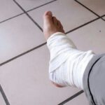 Lansia Mengalami Patah Kaki