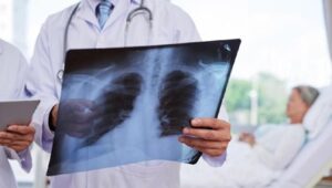 Kurang Istirahat Bisa Picu Pneumonia Berat, Ini Kata Ahli