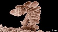 Apa Itu Infeksi “Nightmare Bacteria”? Kasusnya Meledak di AS Membuat Dunia Waspada