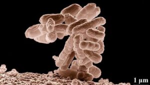 Apa Itu Infeksi “Nightmare Bacteria”? Kasusnya Meledak di AS Membuat Dunia Waspada
