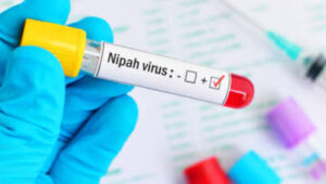 Indonesia Siapkan Reagen PCR dan Perketat Deteksi Dini Antisipasi Ancaman Virus Nipah